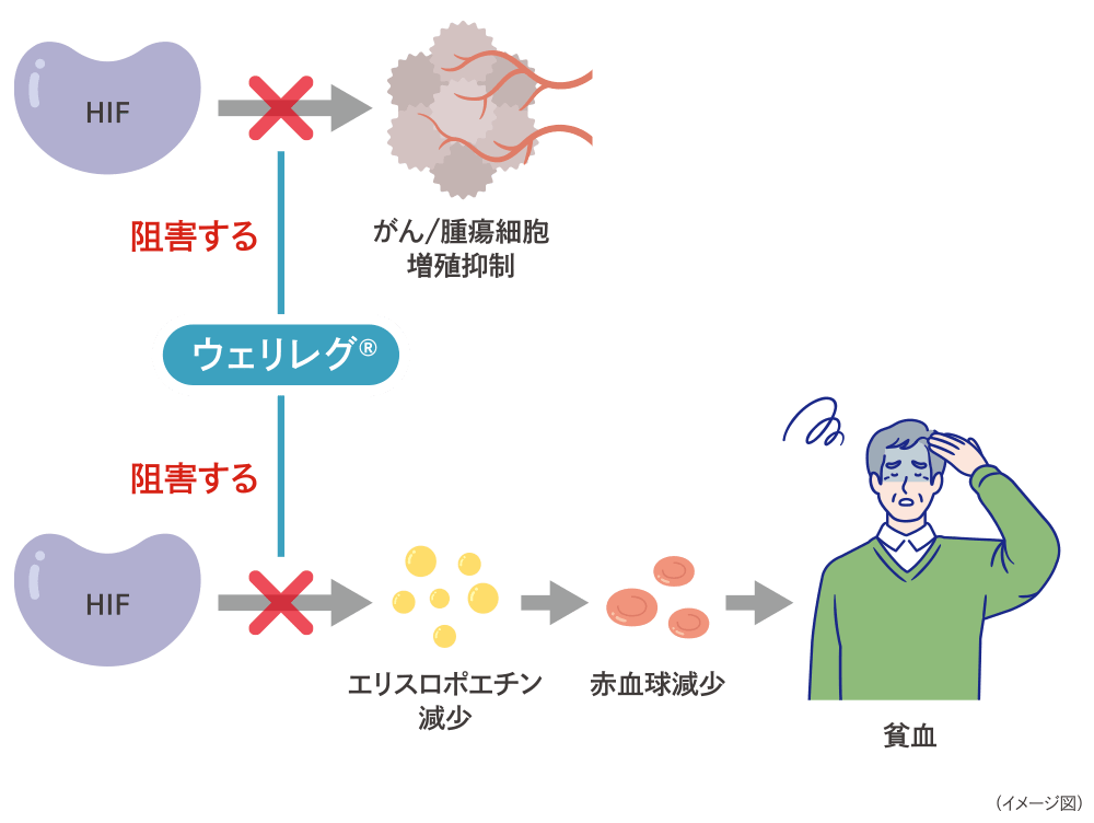 貧血の仕組みのイメージ図